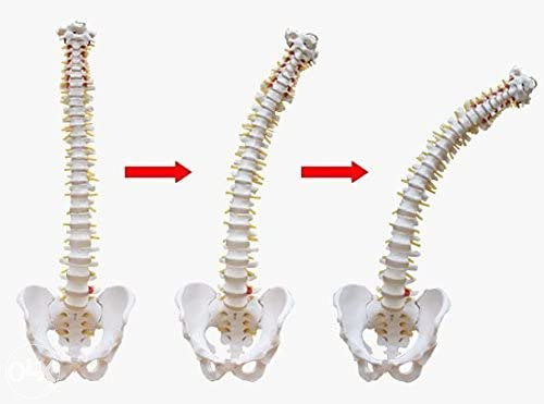 Kralježnica Kičma model anatomija - Ostalo - OLX.ba