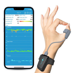 Oksimetar- Smart- alarm upozorenja