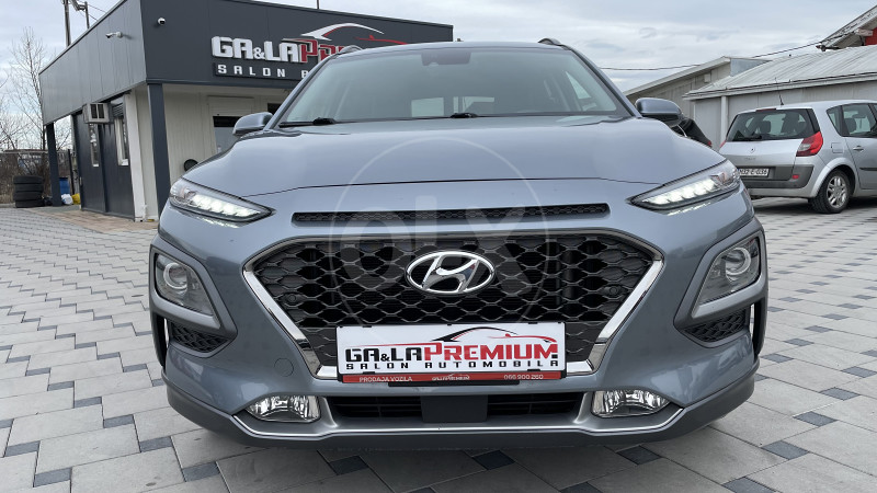 Hyundai Kona Automatik Probleme